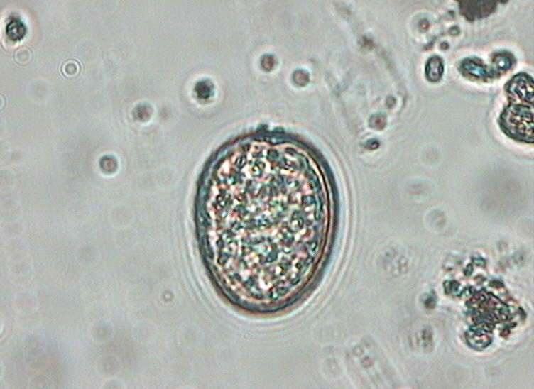 Dictyocha speculum